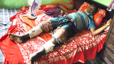 সোনারগাঁয়ে স্বেচ্ছাসেবক দল নেতার দুই পা ভেঙ্গে দিয়েছে সন্ত্রাসীরা