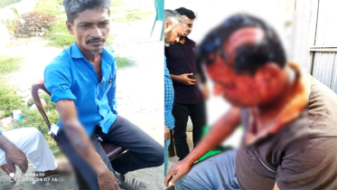 সিদ্ধিরগঞ্জে বিএনপির দুই গ্রুপের সংঘর্ষ, আহত ৩