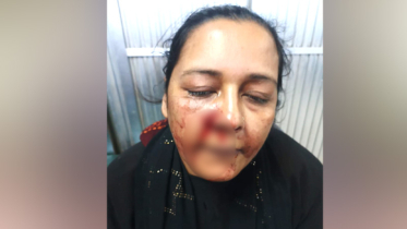 ফতুল্লায় গৃহবধূকে কুপিয়ে হত্যাচেষ্টা, মামলা তুলে নিতে হুমকি