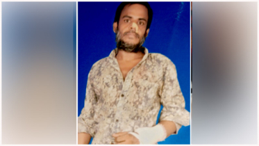 কিস্তির টাকা চাওয়ায় ছোট ভাইকে মারধর করল বোন ও দুলাভাই