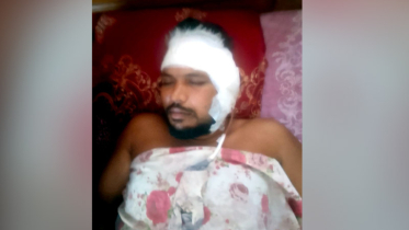 বন্দরে সন্ত্রাসী হামলায় গার্মেন্টস কর্মী আহত, টাকা ও মোবাইল লুট