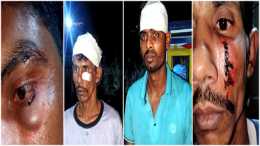সিদ্ধিরগঞ্জে চাঁদা না দেয়ায় অটোরিকশা চালককে মারধর