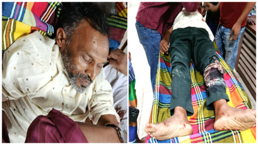 আড়াইহাজারে চাঁদা না দেওয়ায় প্রধান শিক্ষকের ওপর হামলা