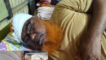 বন্দরে দাবিকৃত ১ লাখ টাকা চাঁদা না পেয়ে ব্যবসায়ীকে কুপিয়ে জখম