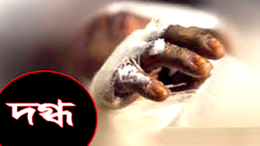 সোনারগাঁয়ে গ্যাস লিকেজ থেকে বিস্ফোরণ, একই পরিবারের ৪ জন দগ্ধ
