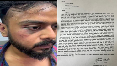 সিদ্ধিরগঞ্জে যুবককে মারধর করে লাখ টাকা ও মোবাইল ছিনতাই